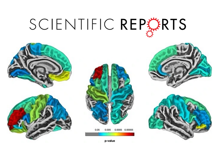 2023-01-27 Взаимосвязь структурных аномалий мозга и нарушений речи у детей школьного возраста c РАС: исследование ФРЦ МГППУ